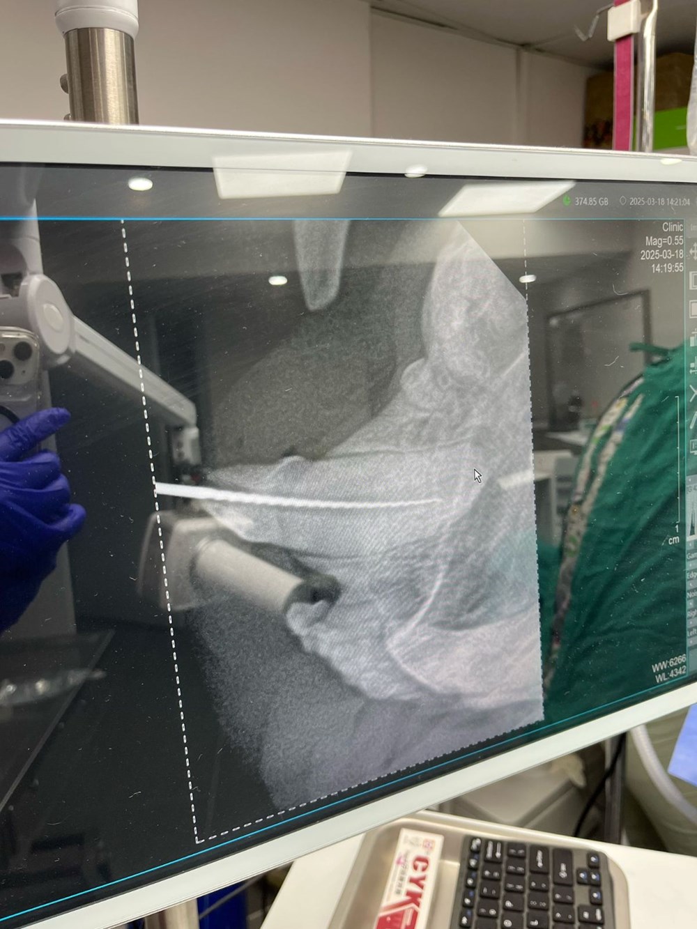 Türkiye'de birinci olabilir: Kediye altından diş yapıldı 74