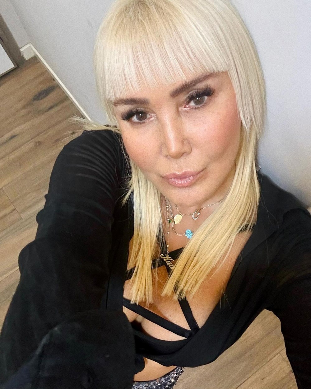 Yonca Evcimik yüzündeki değişimle gündem oldu - 4