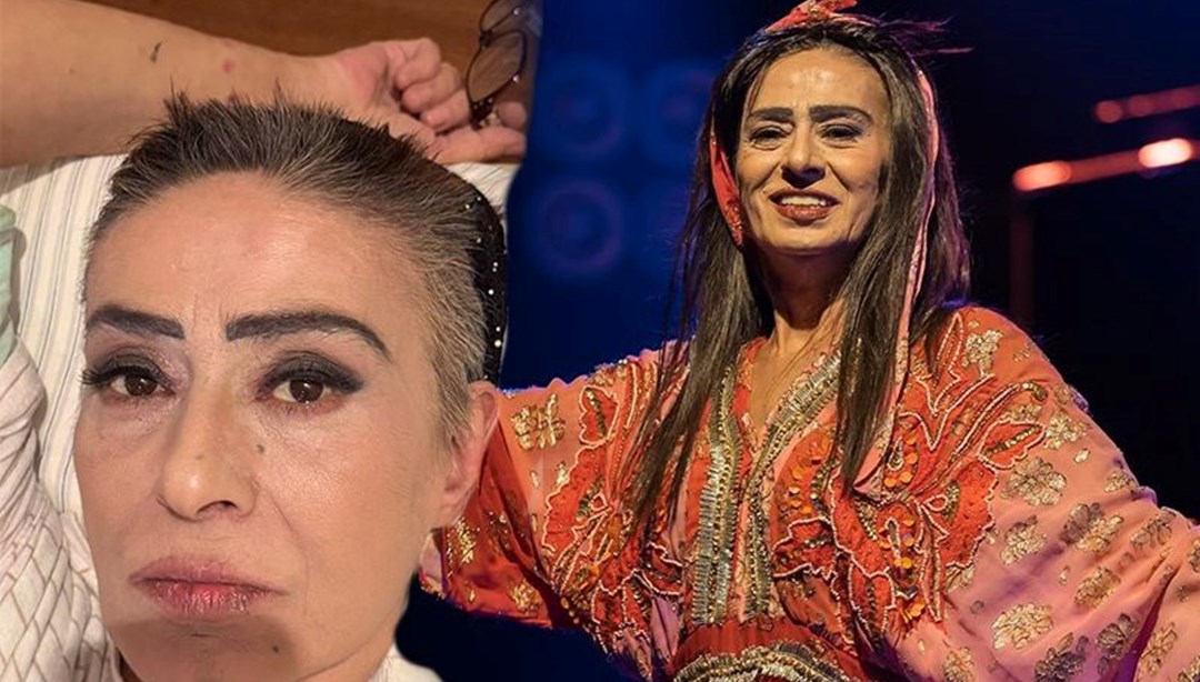 Yıldız Tilbe saçlarını kısacık kestirdi: "Yaralarım geçmeyecekti"