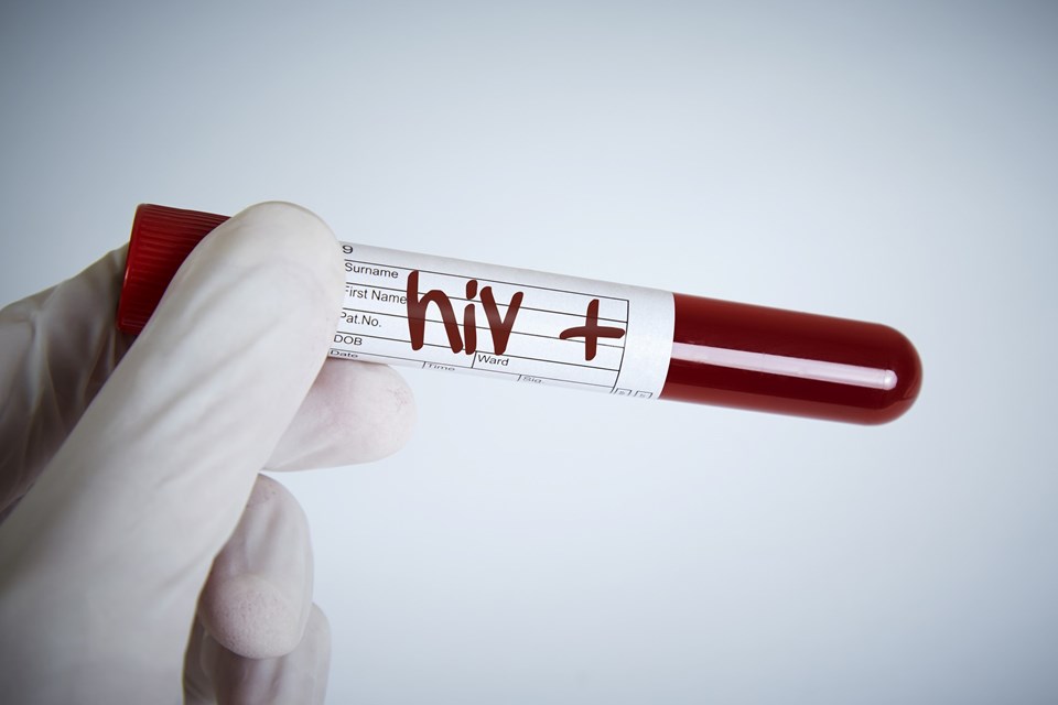 “Haftada 6 bin kadın HIV ile enfekte oluyor” - 2
