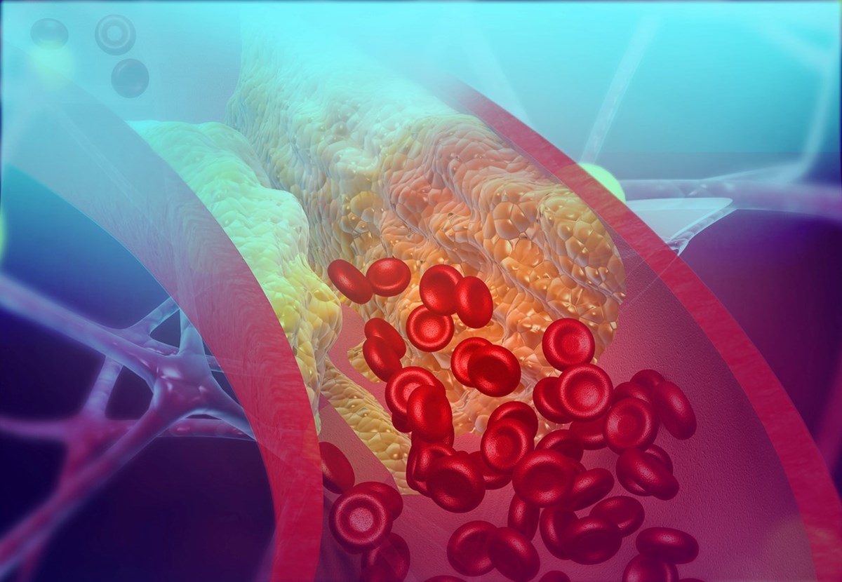 OrganEx sistemi, ölü domuzların kan damarlarına kanla karıştırılmış perfüzat adı verilen bir sıvı pompalayarak çalışıyor.