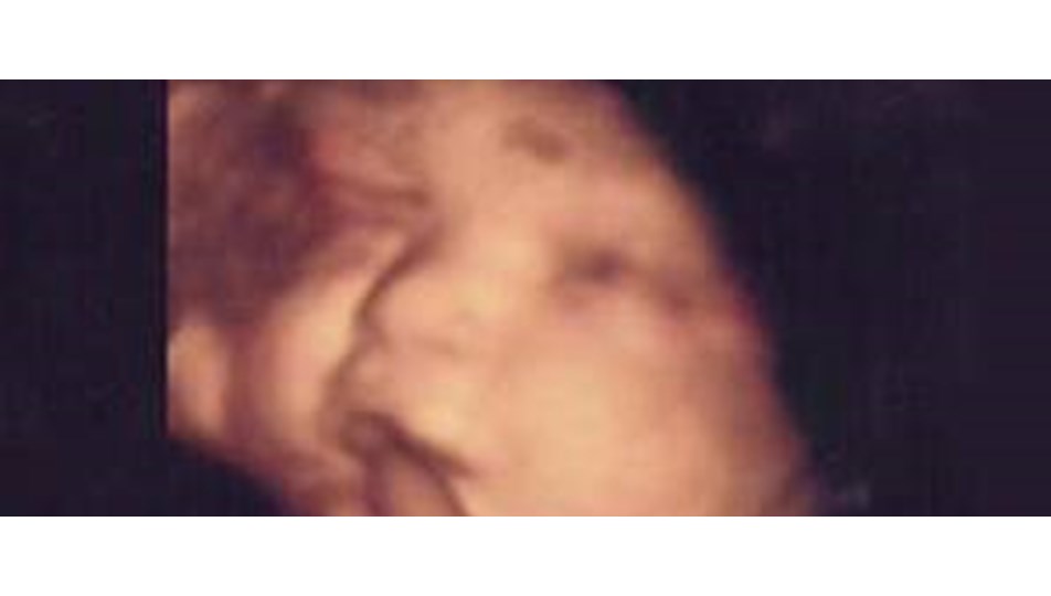 bebeginizle iletisim anne karninda