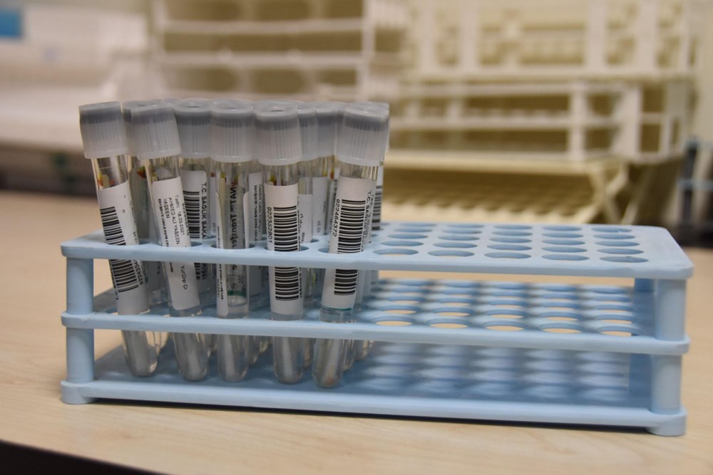 Mutated corona virus cases are detected in 40 minutes - 12