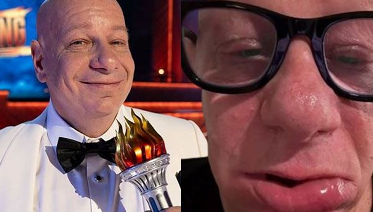 Dondurma yiyen ünlü komedyen hastanelik oldu