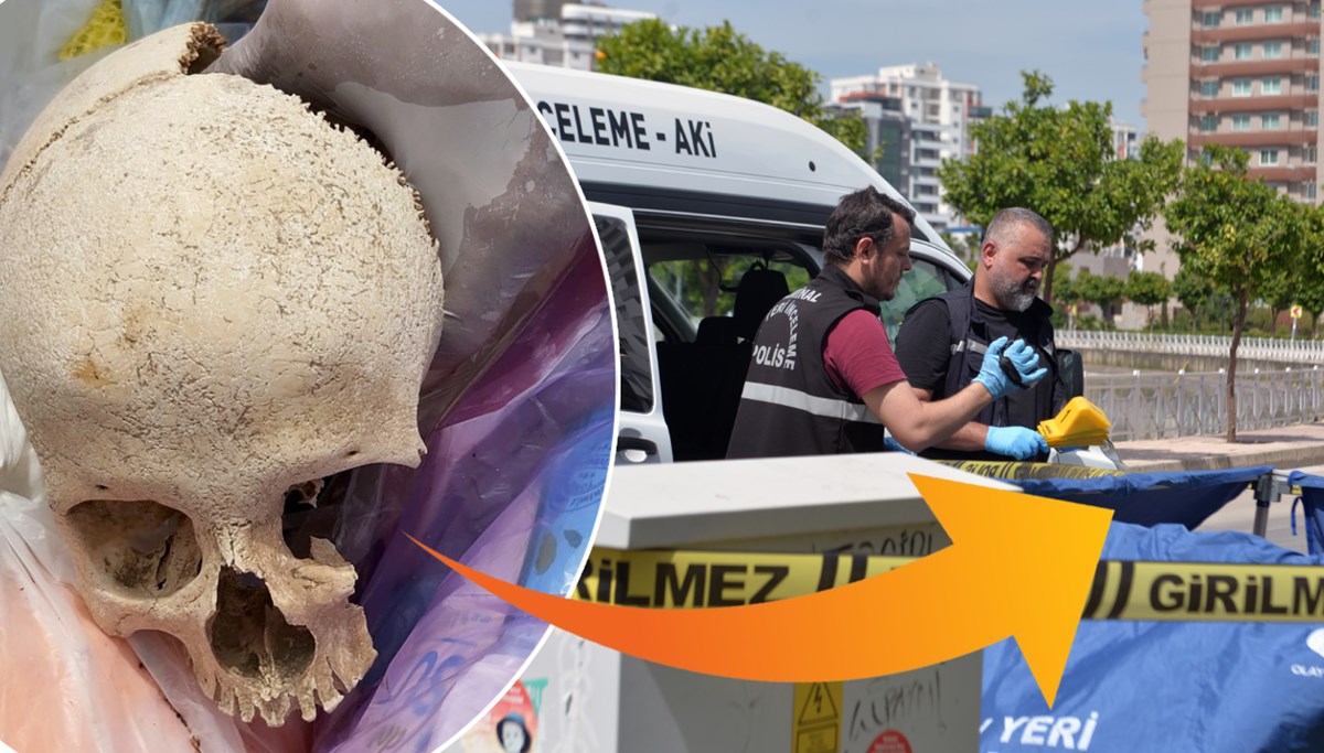Sitenin çöpünden çıkan kafatasının sırrı çözüldü! Uzman doktor gözaltına alındı