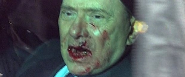 Berlusconi ameliyat oldu
