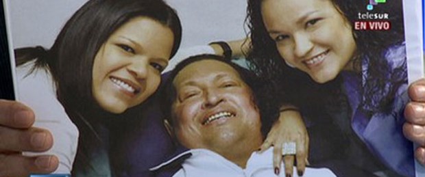 Chavez'in son durumu