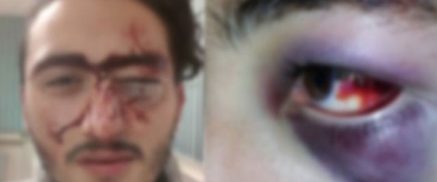 Polis feci şekilde dövdü