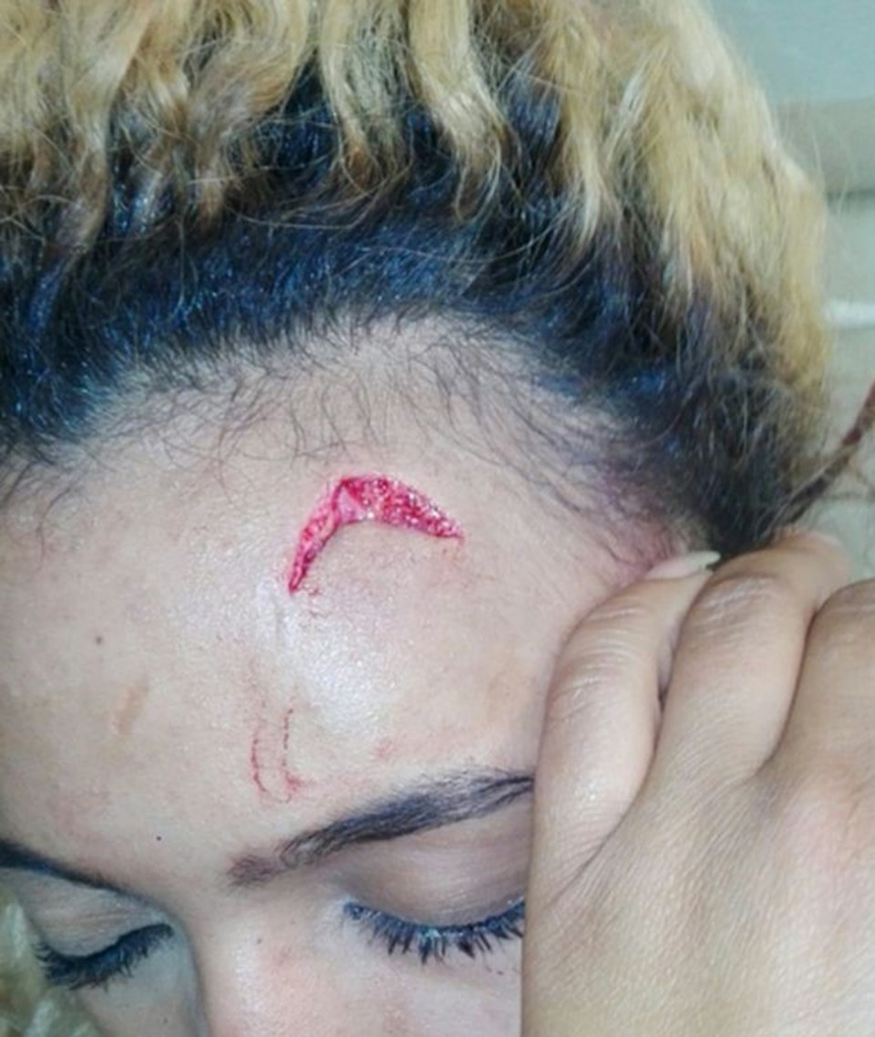 20 yaşındaki Gabriella Engels, Zimbabve Devlet Başkanı'nın eşi Grace Mugabe tarafından darp edildiğini öne sürdü.