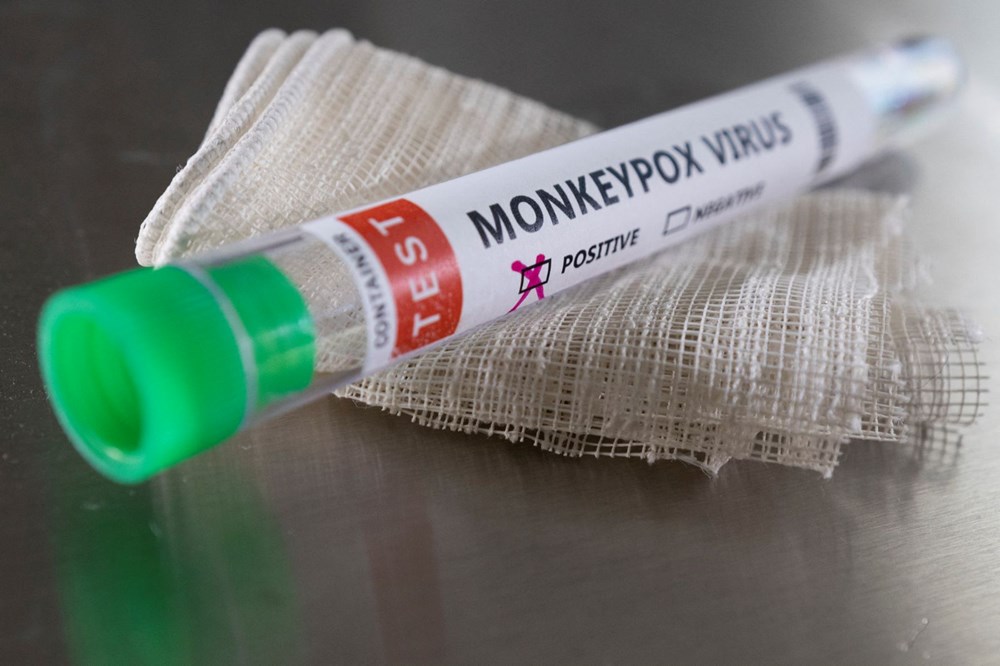 Maymun çiçeği virüsü 21 ülkede görüldü: DSÖ'den cinsel temas uyarısı - 2