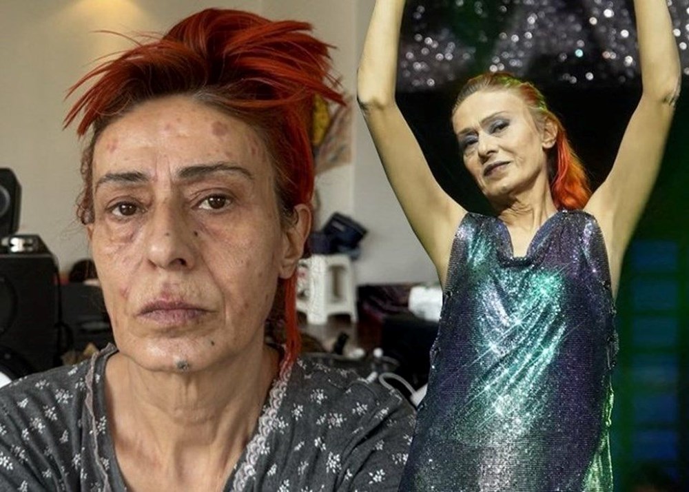 Yıldız Tilbe saçlarını kısacık kestirdi: "Yaralarım geçmeyecekti" - 1
