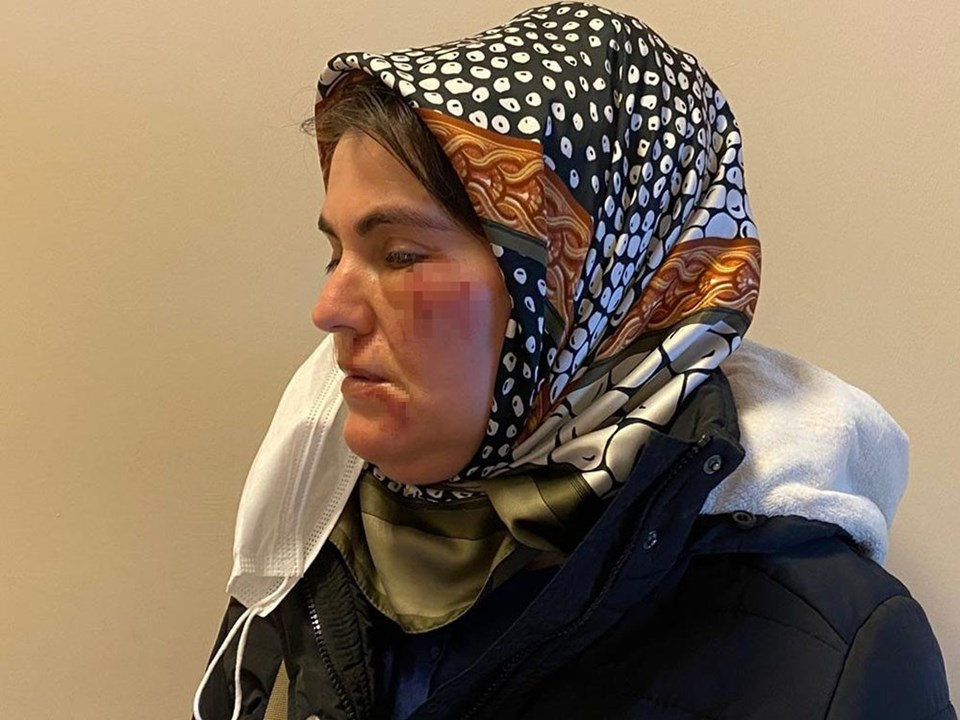 İstanbul'da alışverişten dönen kadına sokak ortasında saldırı - 2
