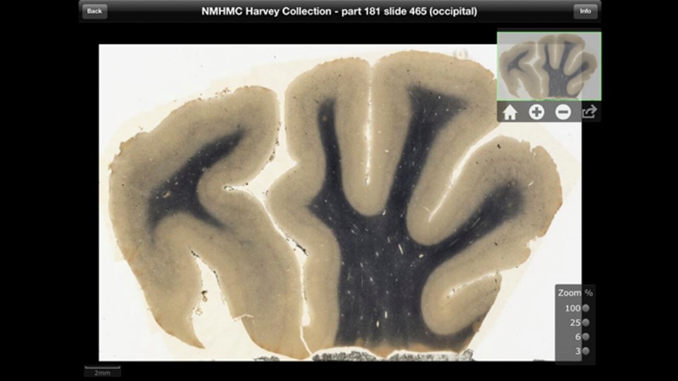 Einstein'ın beyni iPad uygulaması oldu - 2