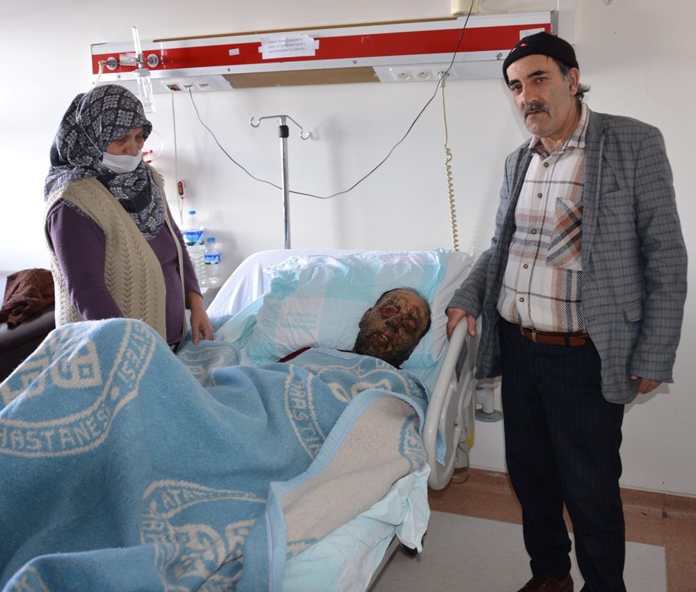 Covid sonrası yüzü çürümeye başladı, aile yardım istedi - 3