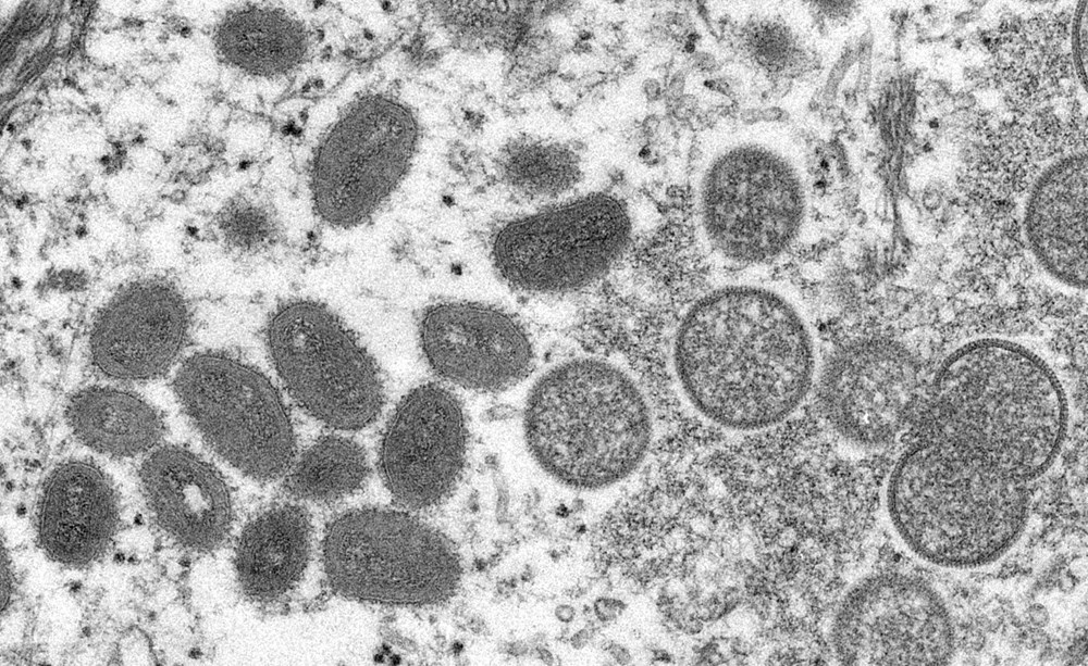 Maymun çiçeği virüsü 21 ülkede görüldü: DSÖ'den cinsel temas uyarısı - 8