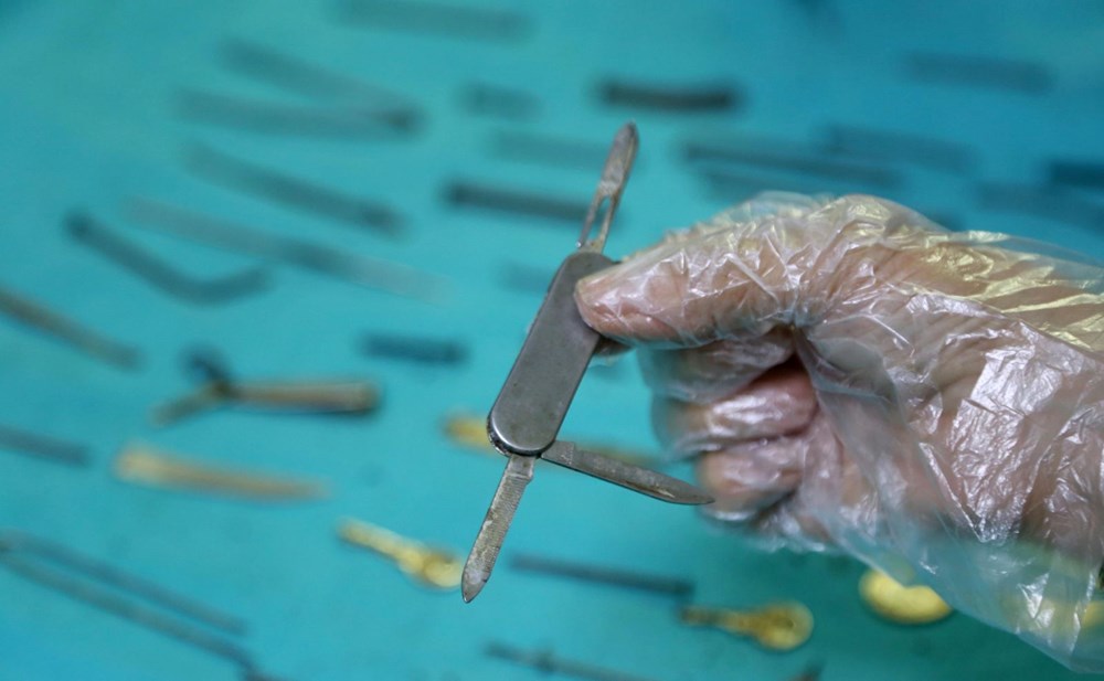 Van'da kadın hastanın midesinden 158 yabancı cisim çıkarıldı - 5