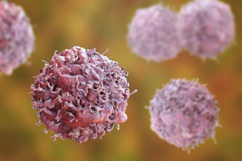 Kanser tedavisi için devrim yaratan gelişme: Yeni bir gen terapisi yöntemi ileri aşamadaki kanseri durdurdu - 2
