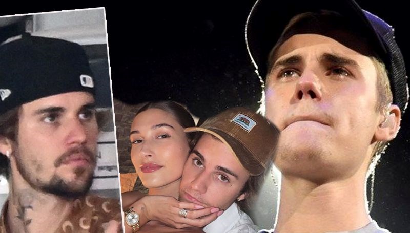 Justin Bieber'ın yüzündeki değişim hayranlarını endişelendirdi