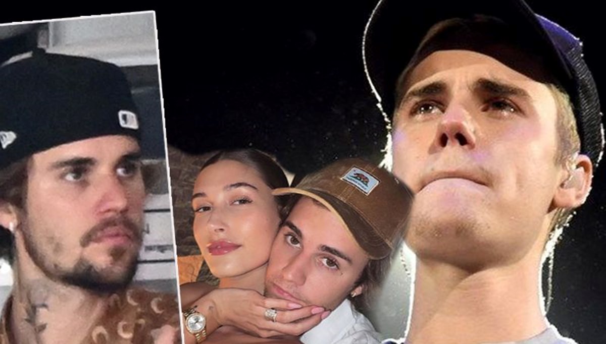 Justin Bieber'ın yüzündeki değişim hayranlarını endişelendirdi