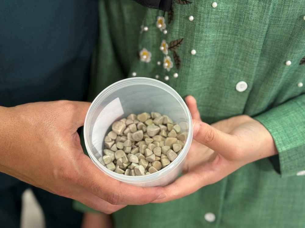 Doktorlar bile şaşırdı: Genç kızın vücudundan 287 adet taş çıkarıldı - 5