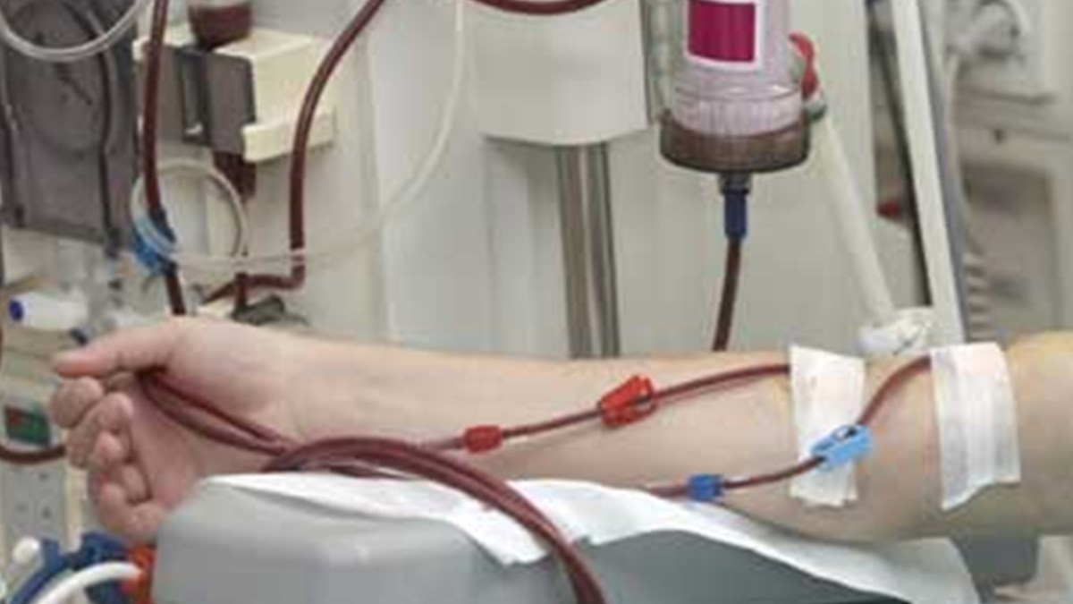 diyaliz hastalarinda intihar egilimi