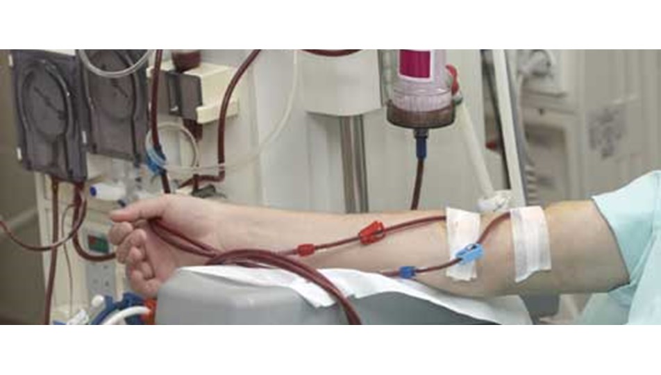 diyaliz hastalarinda intihar egilimi