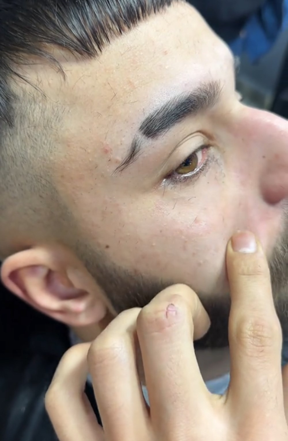 Tiktok'ta "Kirpik kesme akımı" tehlikesi: Gözde kalıcı hasar bırakabilir - 6