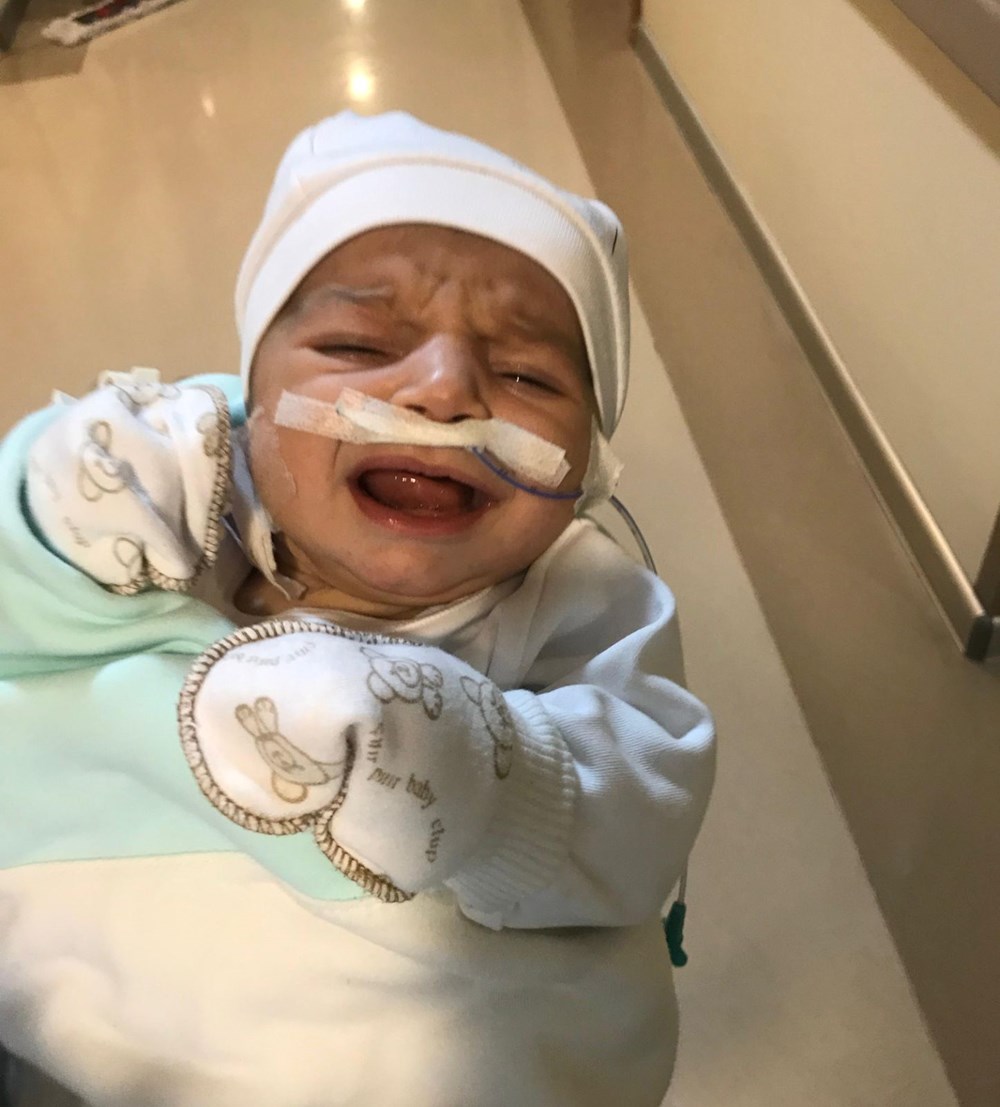 Kalbi "yatay" doğdu, hayatta kalması mucizeydi: Ameliyat sonrası yaşayan ikinci vaka - 5