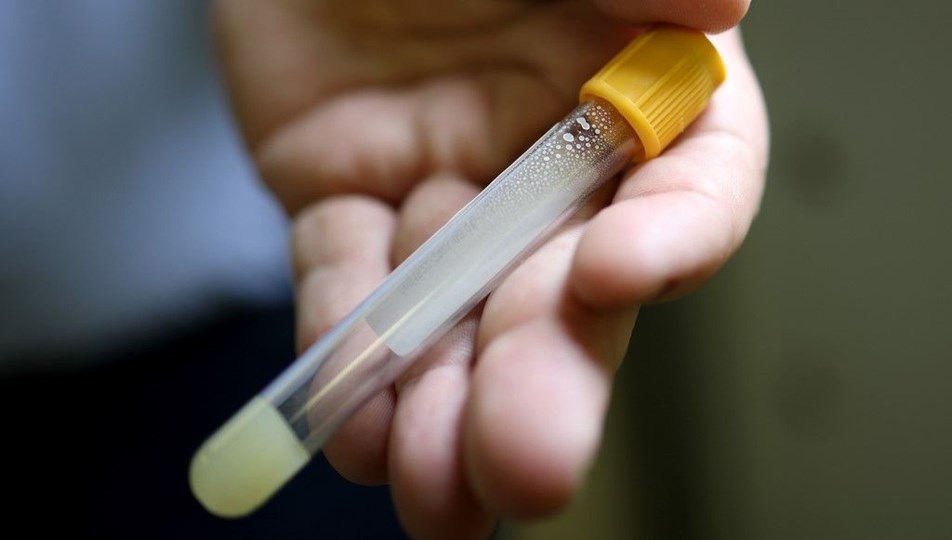 Kan örneğinden virüs tespit eden yeni corona virüs testi geliştirildi