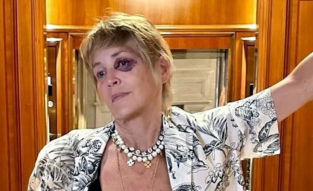 Ünlü oyuncu Sharon Stone'un gözüne ne oldu? - 2