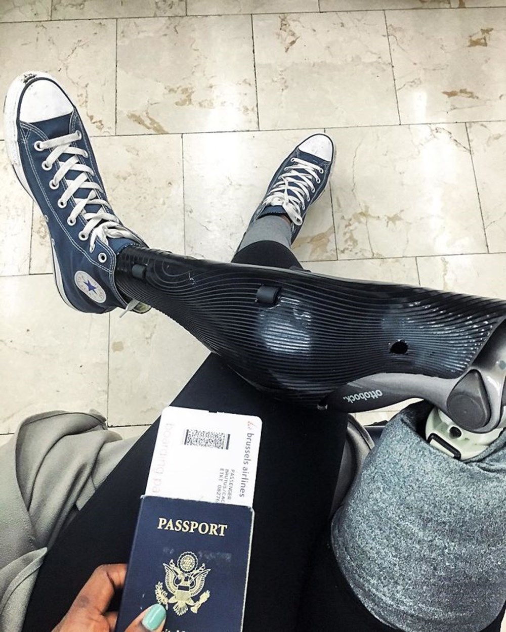 красивые женские ступни. нога поздно. плоскостопие молоткообразная деформация. судорога икроножной мышцы. стопа.