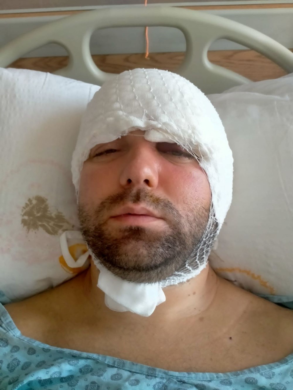 İmplant tedavisinde vida beynine saplandı: Yanlış tedavi hayatını kararttı - 5