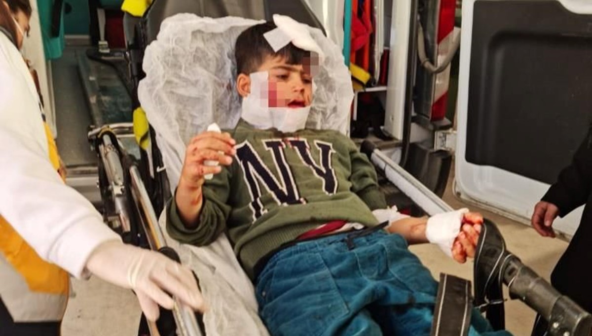 Mardin'de köpeklerin saldırısına uğrayan çocuk ağır yaralandı