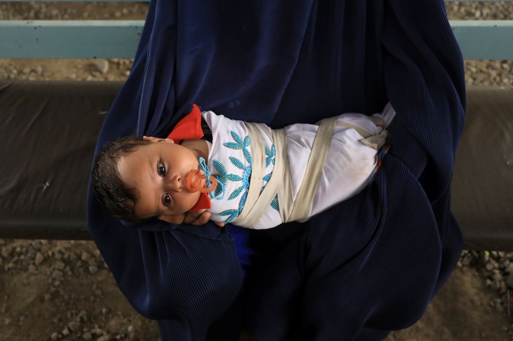 Afgan kız bebek, açlıktan ölmek üzere olan ailesi tarafından 500 dolara satıldı - 5