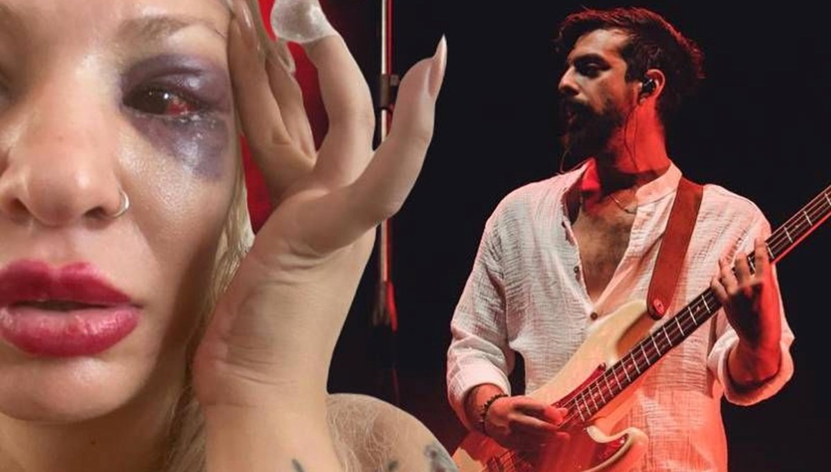 Yüzyüzeyken Konuşuruz'un gitaristi Can Tunaboylu'ya sevgilisini darbettiği iddiasıyla soruşturma Yüzyüzeyken Konuşuruz'un gitaristi Can Tunaboylu'ya sevgilisini darbettiği iddiasıyla soruşturma