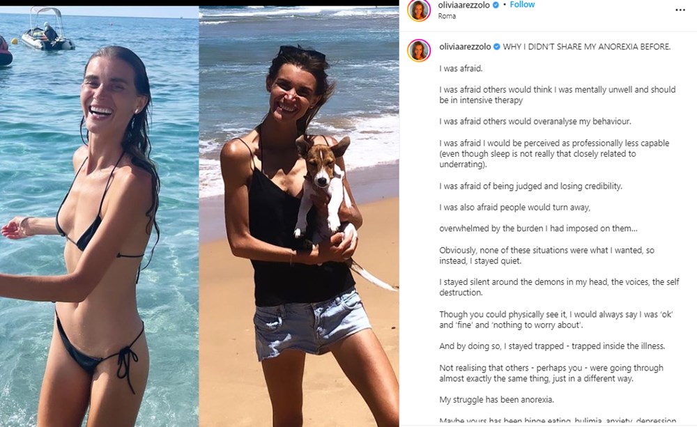 Yeme bozukluğu yaşayan Olivia Arezzolo'nun hayatı bir fotoğrafla değişti - 2