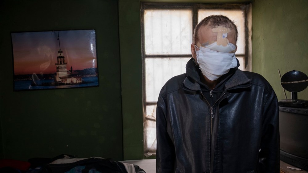 Cilt kanserinden yüzünü kaybeden baba: Kızımı öpmeyi çok özledim - 7