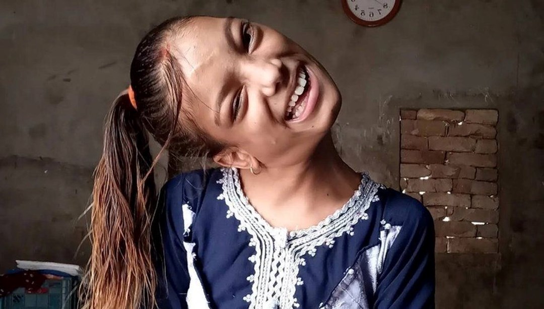 Boynu 90 derece eğik olan kız çocuğunun umut veren hayat hikayesi