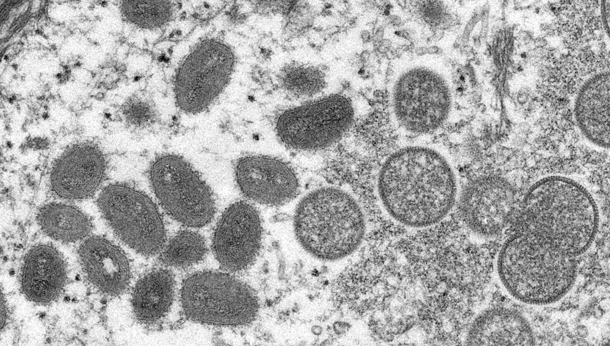 Maymun Çiçeği virüsü nedir, nasıl bulaşır? Maymun Çiçeği (Monkeypox) virüsünün belirtileri nelerdir, öldürür mü, tedavisi var mı?