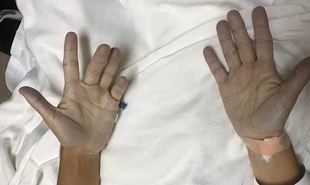 Şirin baba olarak ünlendi: Kocakarı ilacı içtikten sonra ten rengi maviye döndü - 11
