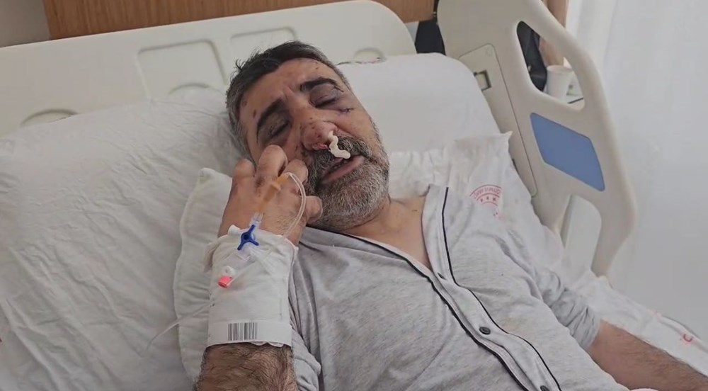 İngiliz boksörün komalık ettiği taksici yoğun bakımdan çıktı, yaşananları anlattı: Öptü, ısırdı, elini gözüme soktu - 5