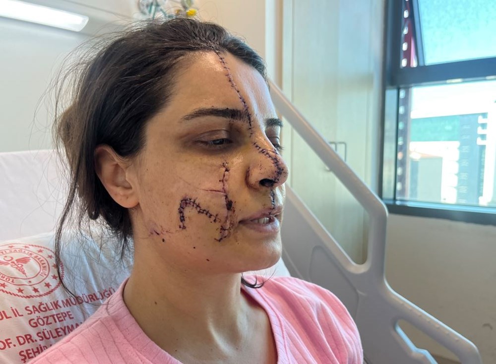 Marmaray saldırganından ağaçta taciz: Saldırıdan önce
defalarca evin önüne gelmiş - 3