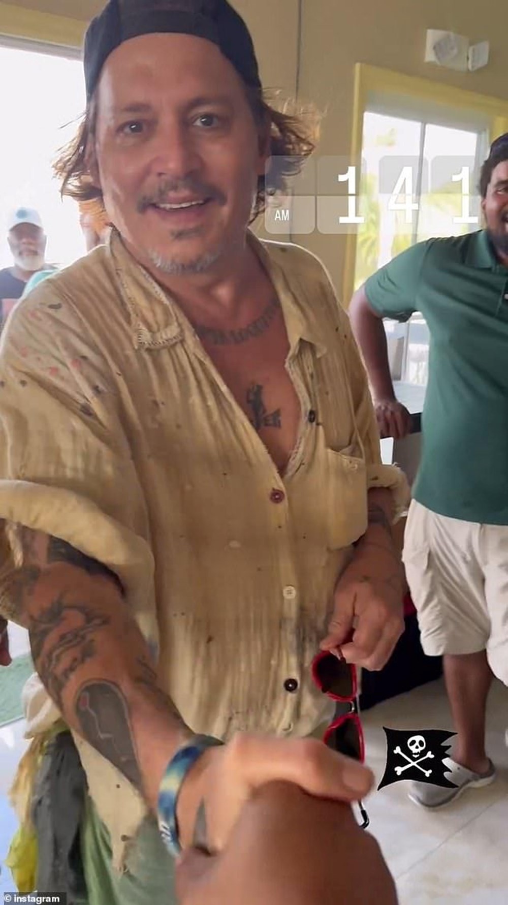 Johnny Depp dişlerini yaptırdı: "Korsan dişleri gitmiş!" - 2