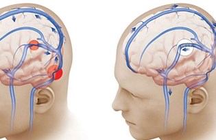 bas agrisindan kurtulmanin 10 yolu