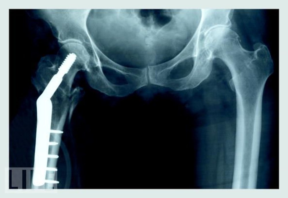 Hayatın röntgeni NTV Hayatın röntgeni NTV