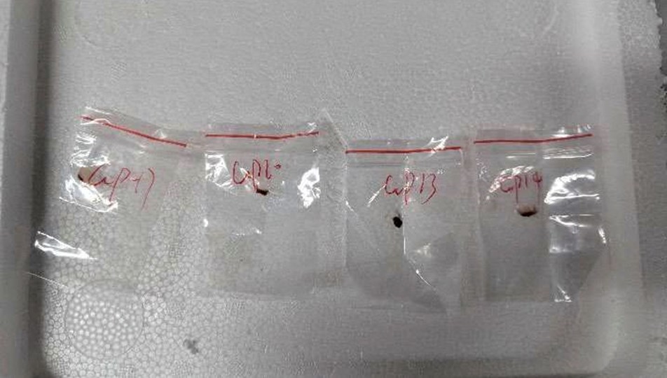 Zehirli mantar operasyonu: Hastalık yayacaklardı, yakalandılar