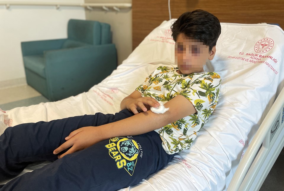 Adana'da 'Ses bombası yapımı' videosu izleyen çocuk, karışımı hazırlarken gözünden yaralandı - 1