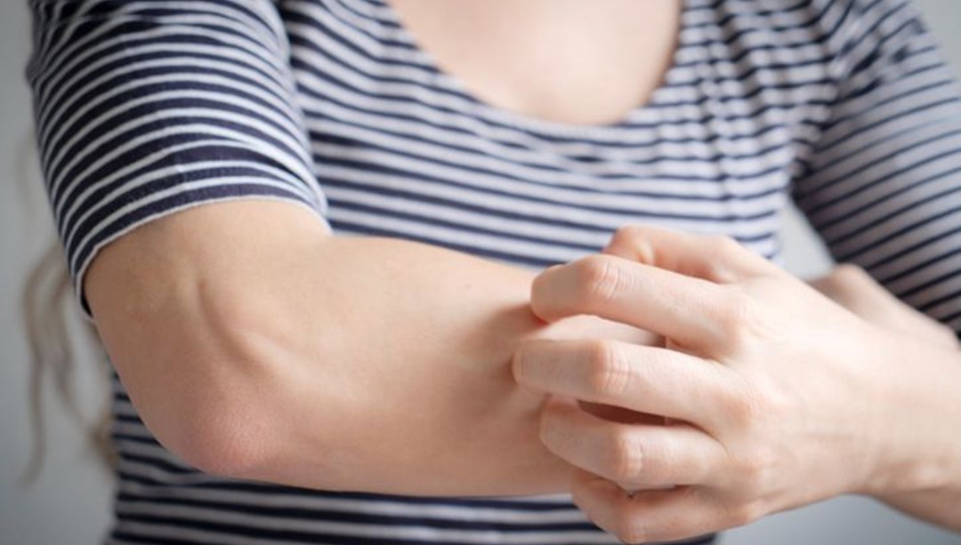 Genellikle egzamayla karıştırılıyor! Kanserin en sinsi belirtisi: Harvardlı uzmanlar uyardı