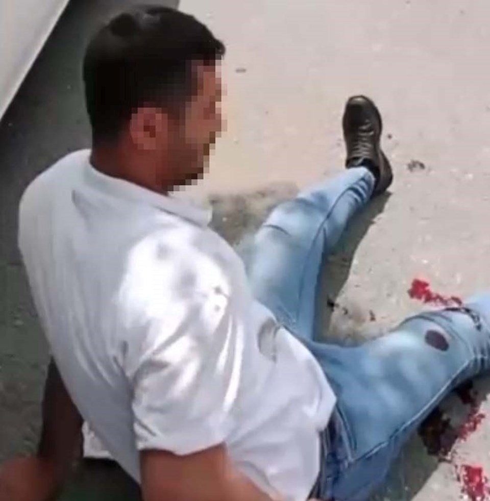 Bacaklarından vurup sosyal medyada paylaştı, tutuklandı - 1