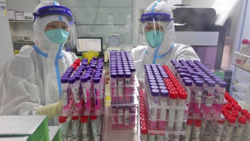 Çin, Covid-19'un kökeninin belirlenmesi amacıyla Wuhan'daki binlerce kan örneğini test edecek - 8